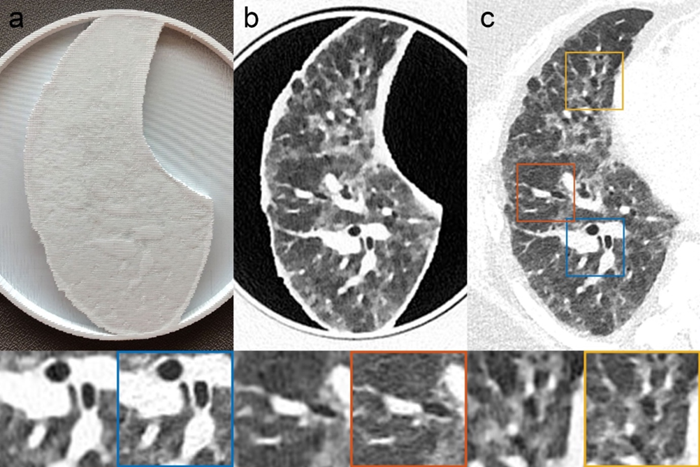 Patient-based Lung Phantom Images, pixel print